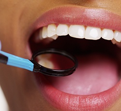 Closeup of healthy teeth and gums