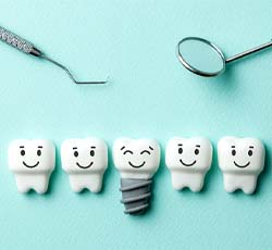 Illustration of dental implant in Lovell