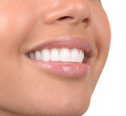 Closeup of healthy smile