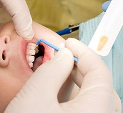 Child receiving fluoride treatment