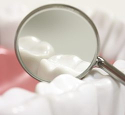 Closeup of teeth with tooth-colored fillings