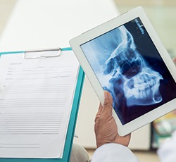 X-ray of jaw and skull