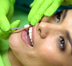 Closeup of patient getting porcelain veneers in Lovell