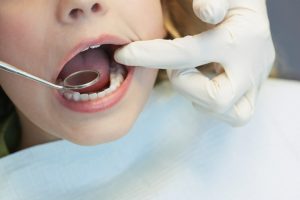 Your family dentist in Lovell treats weakened enamel.