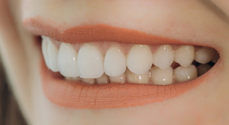 Woman with porcelain veneers in Lovell